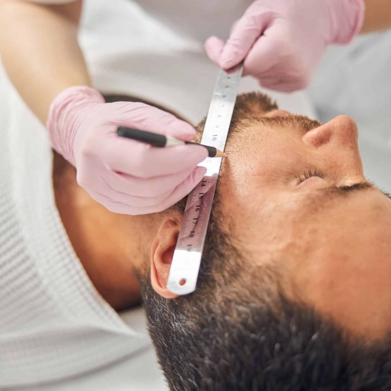 Close up of woman esthetician hands in sterile gloves placing ruler on male cheek and drawing straight line with white pencil
